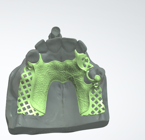 Custom CAD\/Cam Metal Framework te fè nan Lachin